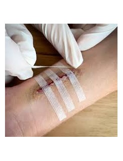 Sachet stérile individuel 3M Steri-Strip 12mm x 100mm.jpg